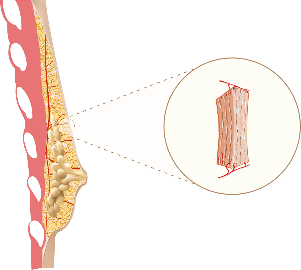 natural breast enhancement with fat transfer