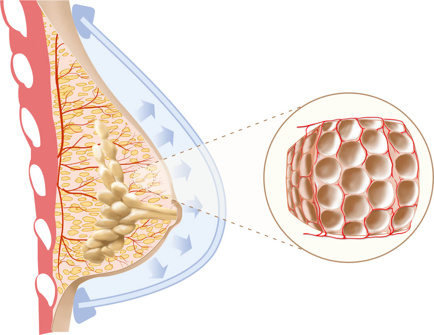 natural breast enhancement with fat transfer