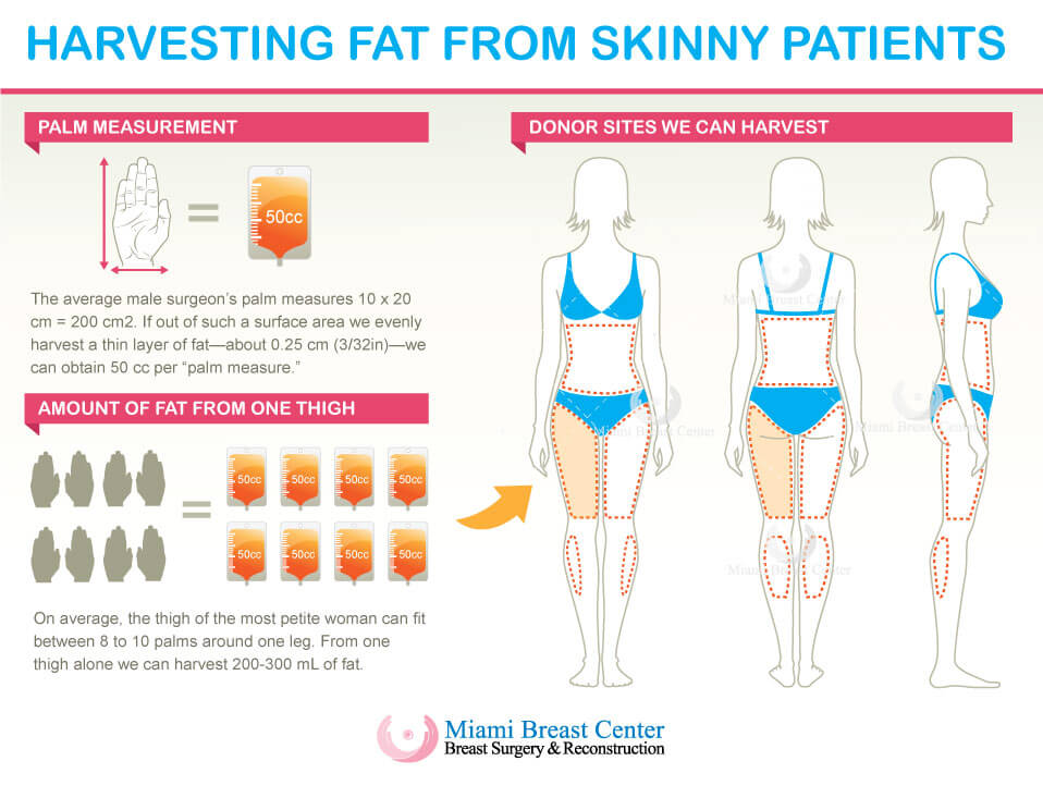 too-thin-skinny-fat-transfer